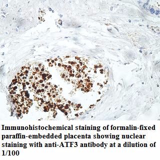 ATF3 Antibody
