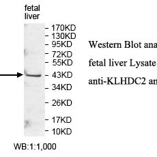 KLHDC2 Antibody