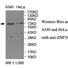 ZNF398 Antibody
