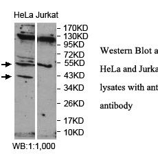 FRMD8 Antibody