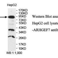 ARHGEF7 Antibody
