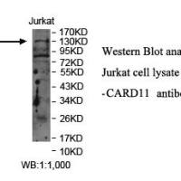 CARD11 Antibody
