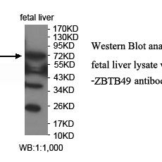 ZBTB49 Antibody