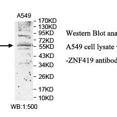 ZNF419 Antibody