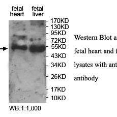 ZNF556 Antibody