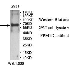 PPM1D Antibody