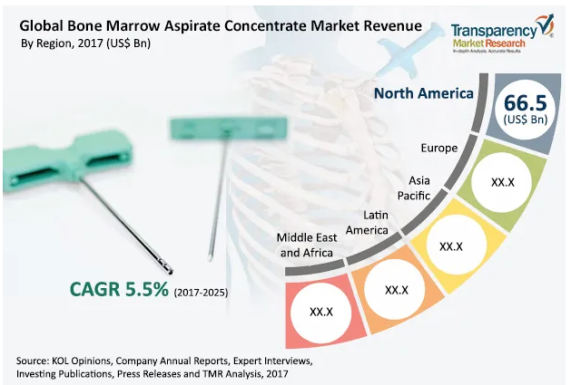 全球骨髓浓缩物市场报告 细胞疗法成为骨科市场的新主流