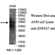 ZNF627 Antibody