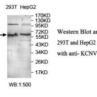 KCNV2 Antibody