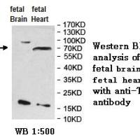 TRIM3 Antibody