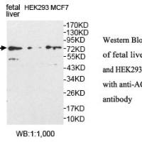 ACOX1 Antibody