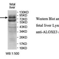ALOXE3 Antibody