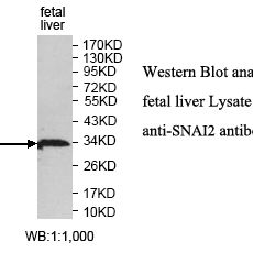 SNAI2 Antibody