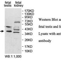 IZUMO1 Antibody