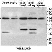 ZAP70 Antibody