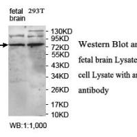 KCNC3 Antibody
