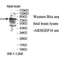 ARHGEF16 Antibody