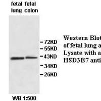 HSD3B7 Antibody