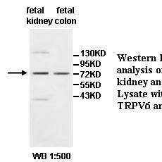 TRPV6 Antibody