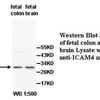 ICAM4 Antibody