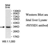 PHYHD1 Antibody
