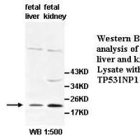 TP53INP1 Antibody