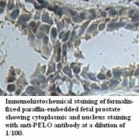 PELO Antibody