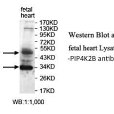 PIP4K2B Antibody