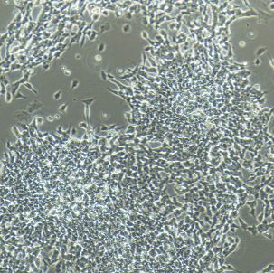 SH-SY5Y人神经母细胞瘤细胞/STR鉴定/镜像绮点（Cellverse）