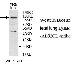 ALS2CL Antibody