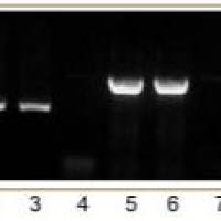 TRIzol Reagent
