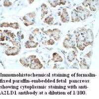 A2LD1 Antibody