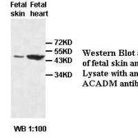 ACADM Antibody