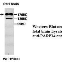 PARP14 Antibody