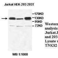 TNKS2 Antibody