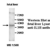 IL1B Antibody