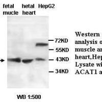 ACAT1 Antibody