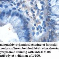 HMBS Antibody