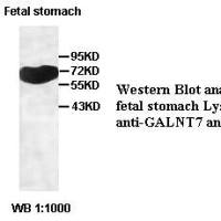 GALNT7 Antibody