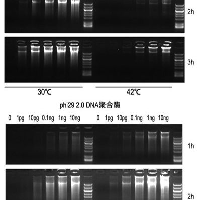 phi29 DNA Polymerase	