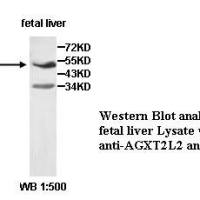 AGXT2L2 Antibody