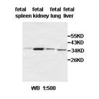 ACBD4 Antibody