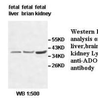 ADORA2B Antibody