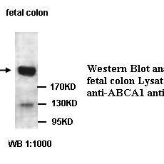 ABCA1 Antibody