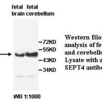SEPT4 Antibody