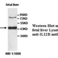 IL12B Antibody