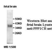 PPP1CB Antibody
