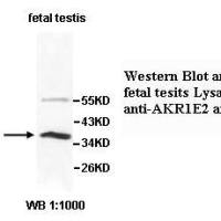 AKR1E2 Antibody
