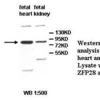 ZFP28 Antibody