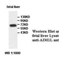 AIM1L Antibody